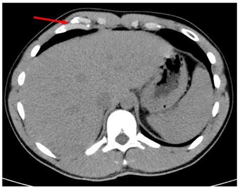 Surgeries | An Open Access Journal from MDPI