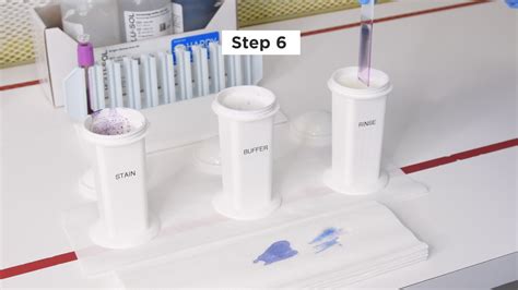 How to do a Wright-Giemsa Stain
