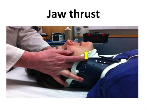Modified Jaw Thrust