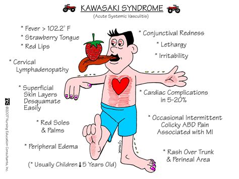 What Are The Side Effects Of Kawasaki Disease at Sherry Ramos blog