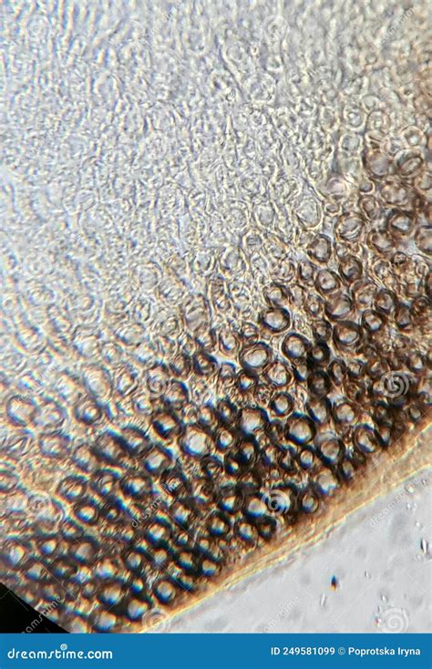 The Structure of the Myelin Nerve Fiber Under the Microscope Stock ...