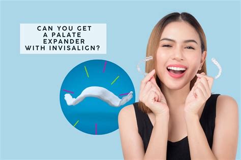 Invisalign Expander 的图像结果