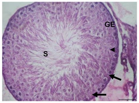 Extra Virgin Olive Oil Protects the Testis and Blood from the Toxicity ...