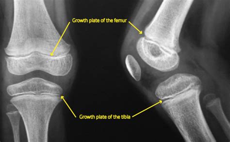 Image result for Appendix with Screen Shot Example