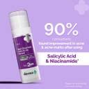 The Derma Co Sali-Cinamide Anti-Acne Face Serum with 2% Salicylic Acid ...