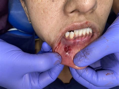 Blog & Testimonials | Shree Rishabh Dev Dental Care And Implant Centre ...