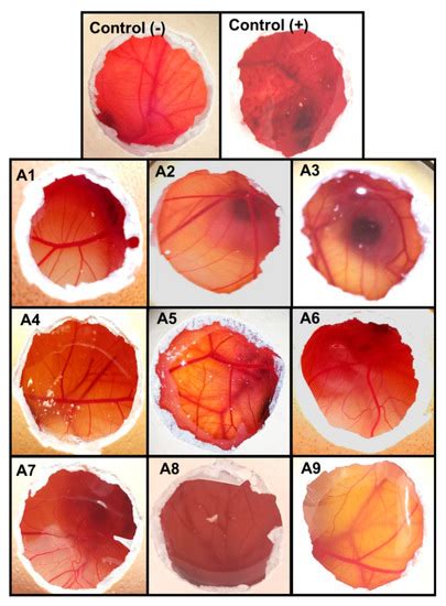 In Vitro and Ex Vivo Evaluation of Nepafenac-Based Cyclodextrin ...