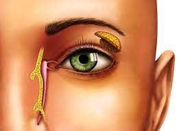 Best Ayurvedic & Panchakarma Hospital in Nagpur | Anandlok Ayurveda