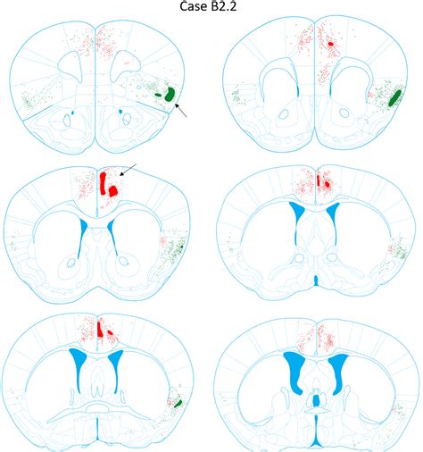 Image result for Cingulate cortex Anatomy