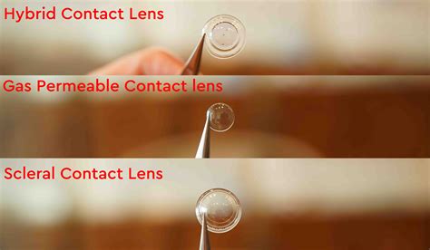 Scleral Contact Lenses Keratoconus