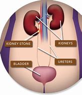 Image result for Kidney and Bladder