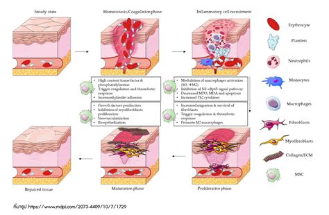 ปัจจัยต่างๆที่ส่งผลต่อกระบวนการการหายของบาดแผล | Best Equipment Center ...