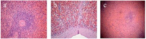 Characteristics of the Cardiosplenic Axis in Patients with Fatal ...