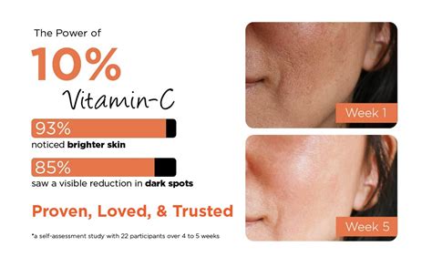 BioBird 10% Vitamin C Face Serum with Niacinamide, Tranexamic Acid ...