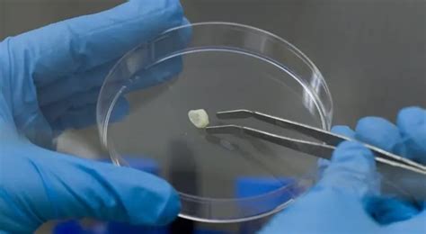 Выращивание зубов – технология будущего 🦷 Когда начнут выращивать зубы ...