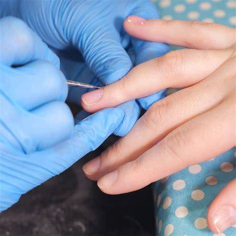 Nail Surgery in Jayanagar | Epiderma Clinic