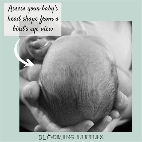 WONDERING IF YOUR BABY HAS A FLAT HEAD?—HERE’S WHAT YOU NEED TO KNOW ...