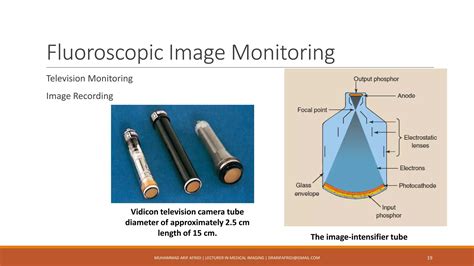 Image result for Conventional Fluoroscopy