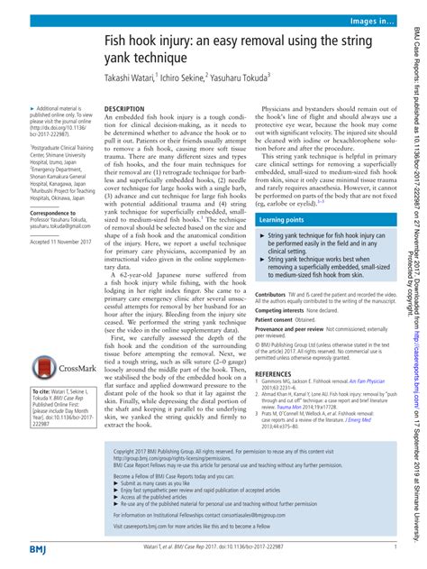 Image result for String Yank Method