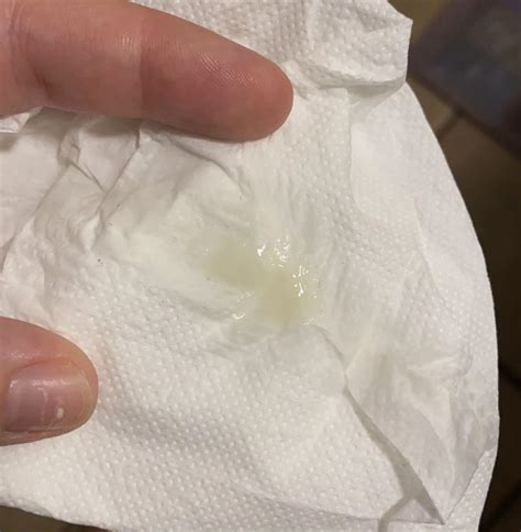 Mucus Plug Discharge Pieces