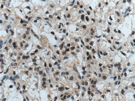 TFE3 antibody (14480-1-AP) | Proteintech