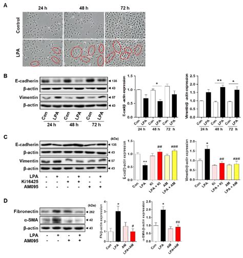 Image result for LPL LPAR