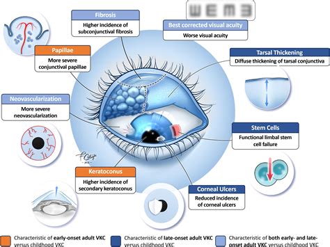 Frontiers | Vernal keratoconjunctivitis in adults: a narrative review of prevalence ...