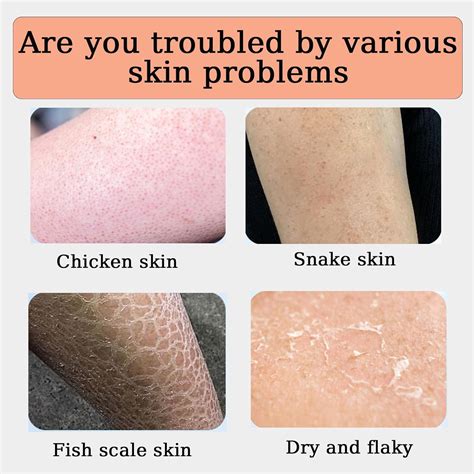 SUBMETIC Strawberry Legs - Strawberry Skin Resurfacing Cream, India | Ubuy