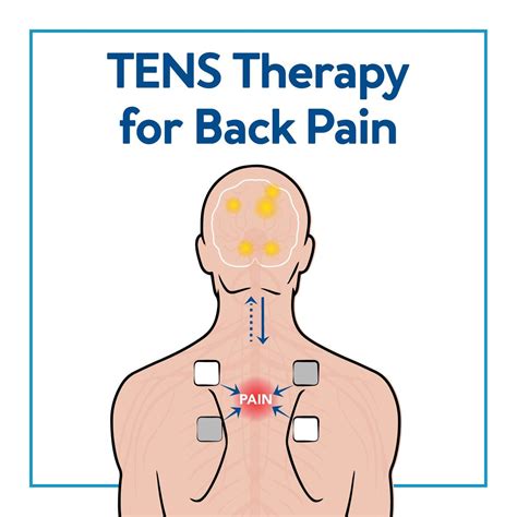 Tens Placement Chart