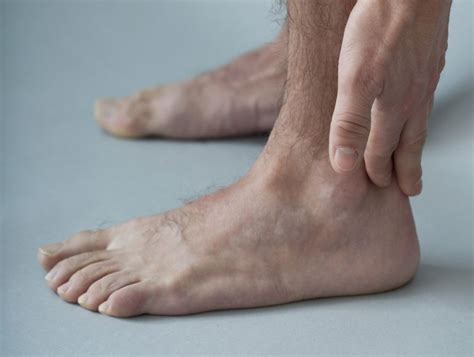 Tendonitis of the Foot and Ankle - Causes and Treatment