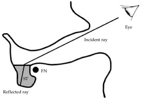 Image result for Refraction of Light in Microscope Images