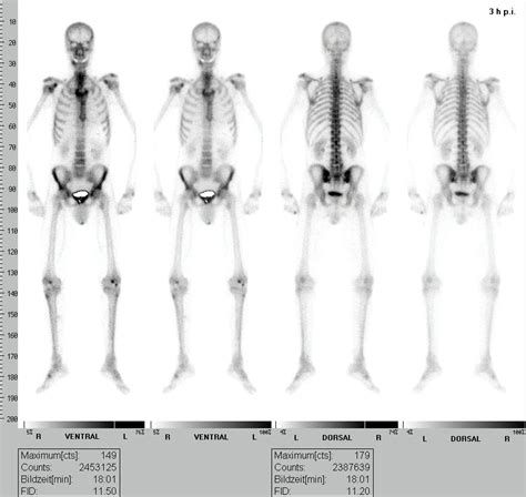 Image result for Email Pattern JavaScript