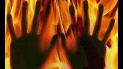 Baroda Dairy Worker Succumbs To Burn Injuries: Baroda Dairy worker ...