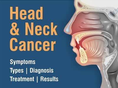 Head And Neck Cancer Symptoms: 7 Warning Signs of Head Neck Cancer You ...