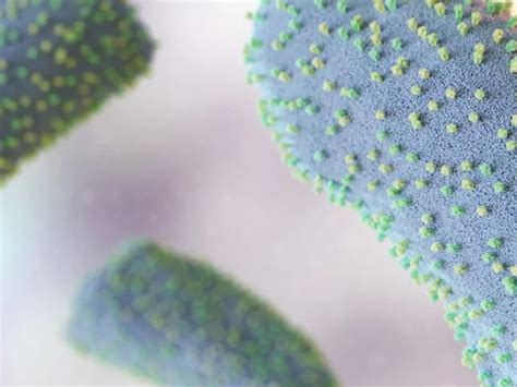 Hair Fall Reasons: पुरुषों से एकदम अलग हैं महिलाओं में गंजेपन (Alopecia ...