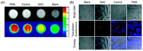 Dual-Mode Tumor Imaging Using Probes That Are Responsive to Hypoxia ...