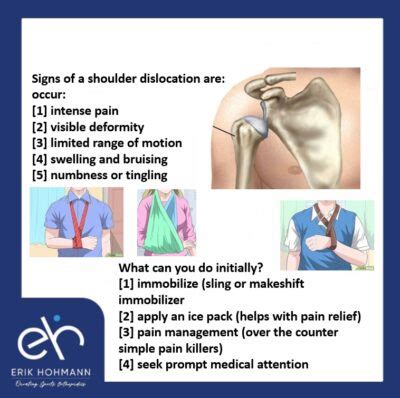 Image result for Sulcus Sign Shoulder Dislocation