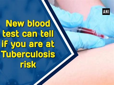 New blood test can determine if you are at Tuberculosis risk - IBTimes ...