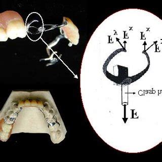 Image result for Clasp Method