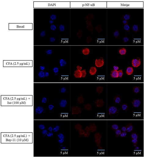 Isoleucilactucin Ameliorates Coal Fly Ash-Induced Inflammation through ...