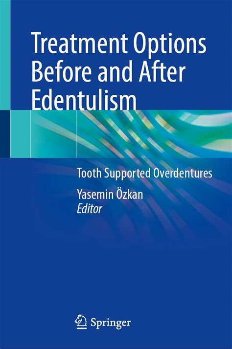 Buy Treatment Options Before and After Edentulism: Tooth Supported ...