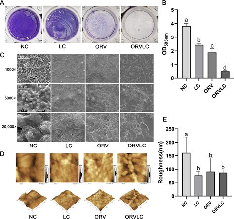 Streptococcus Salivarius 1000x