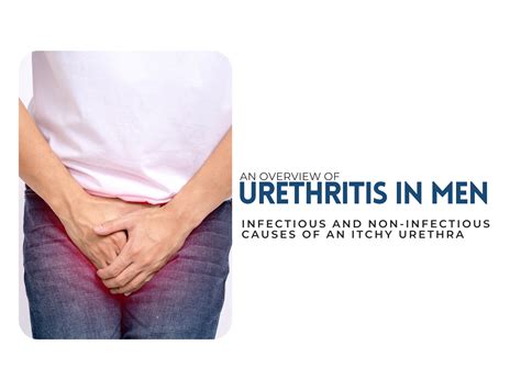 Menopause Itchy Urethra at Adam Hebert blog