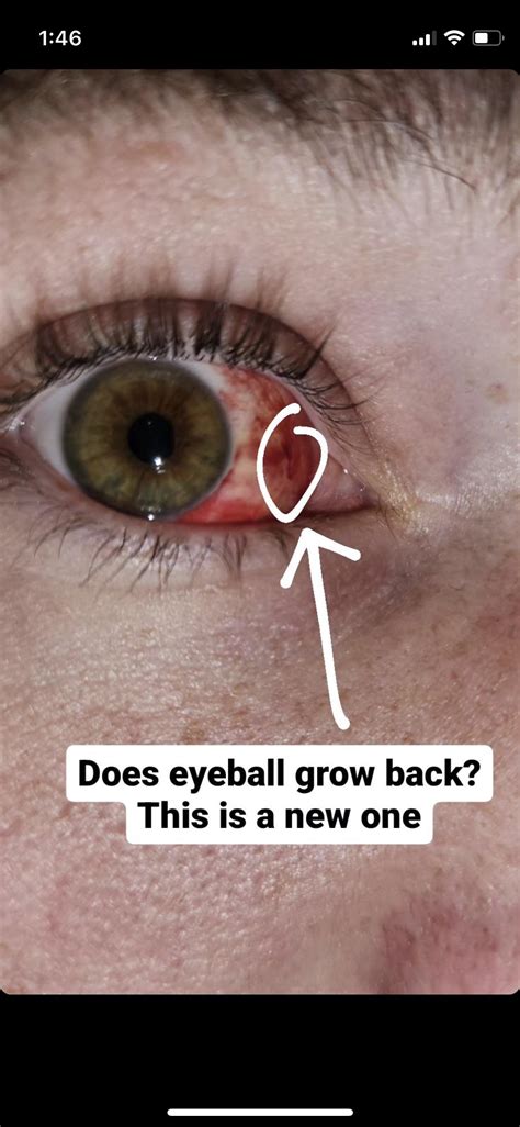 UFC's Sean Strickland provides graphic eye update with a tiny chunk missing