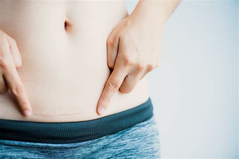 The Untapped Strategy You Need To Stop Your C-Section Scar From Itching ...