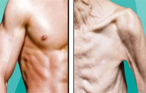 Ghrelin may be an effective treatment for age-related muscle loss