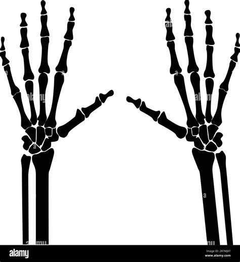 X ray hand arthritis Stock Vector Images - Alamy
