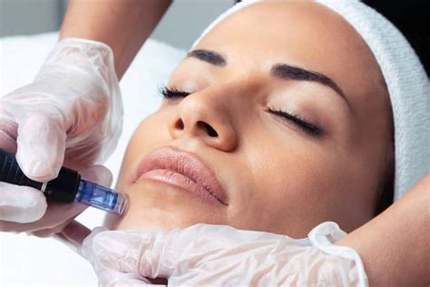 Exosome Therapy | Skin104