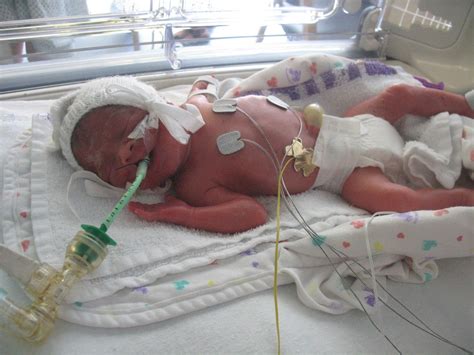 birth at 27 weeks - hiccups pregnancy