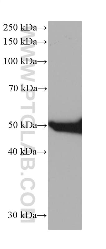 Cytokeratin 8 antibody (68627-1-Ig) | Proteintech